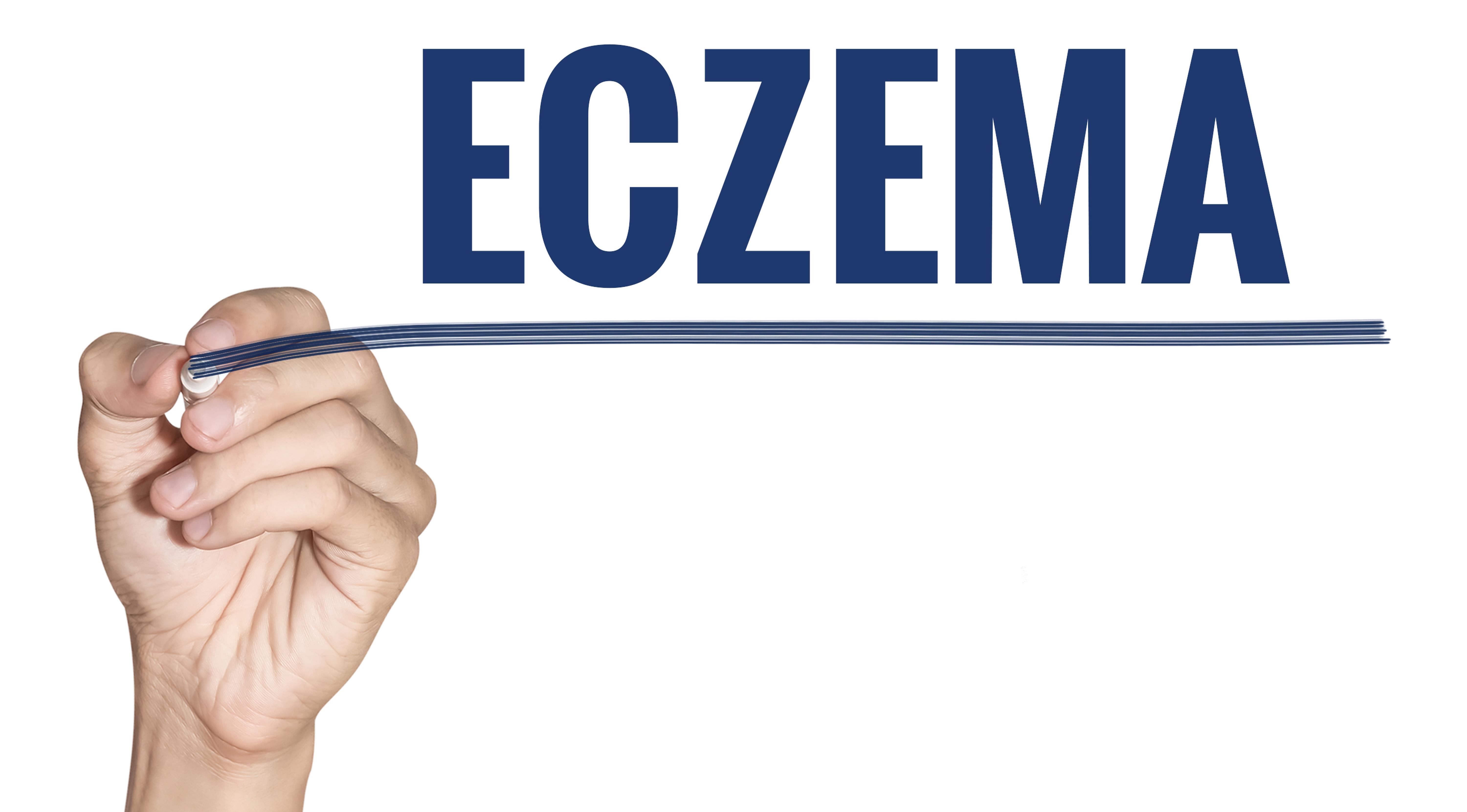 The biggest problem for people affected by eczema? Other people