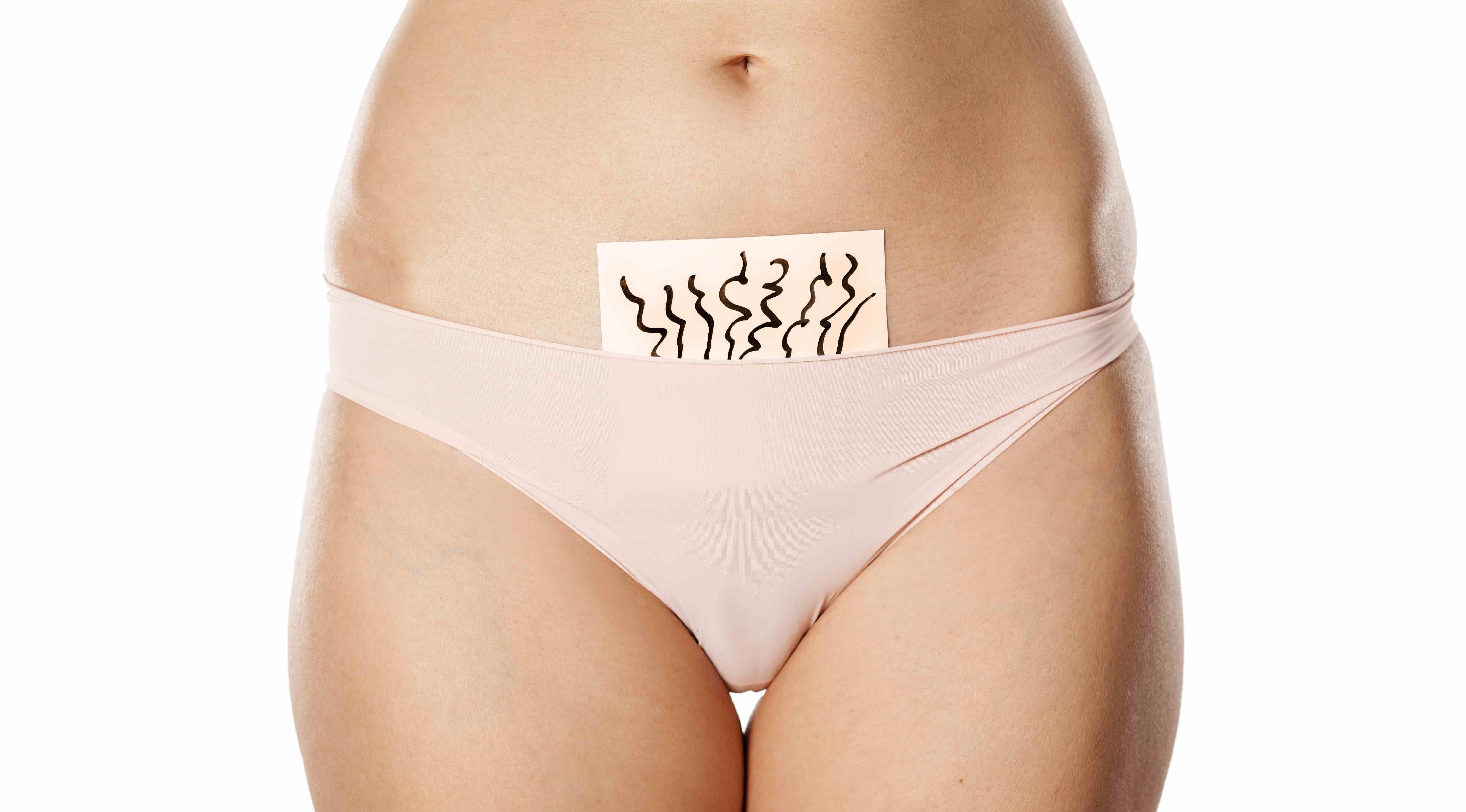 Surge in bikini-line hair transplants says DHI Global