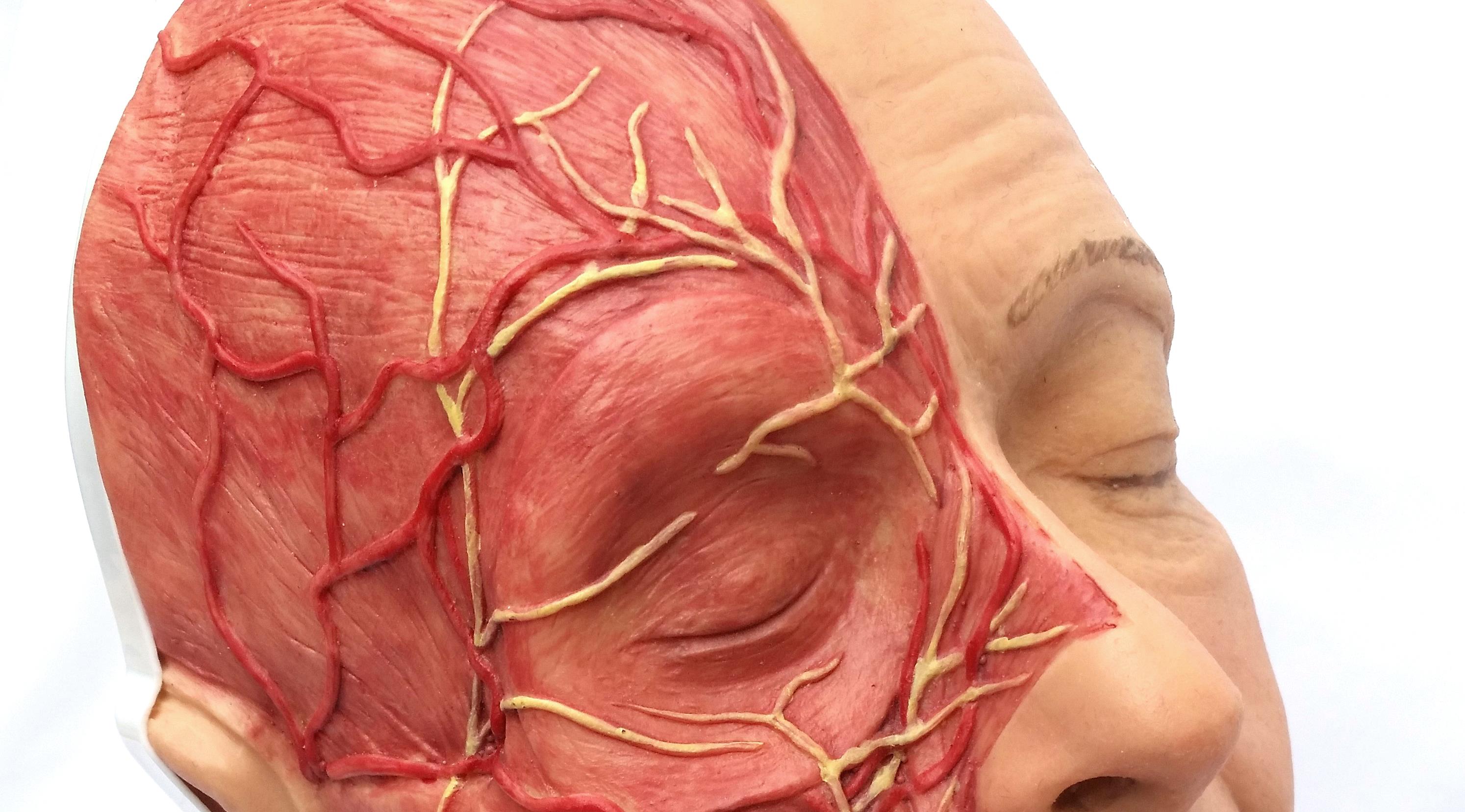 Dr Sabrina Shah-Desai co-develops silicone training head for periorbital and midface injecting