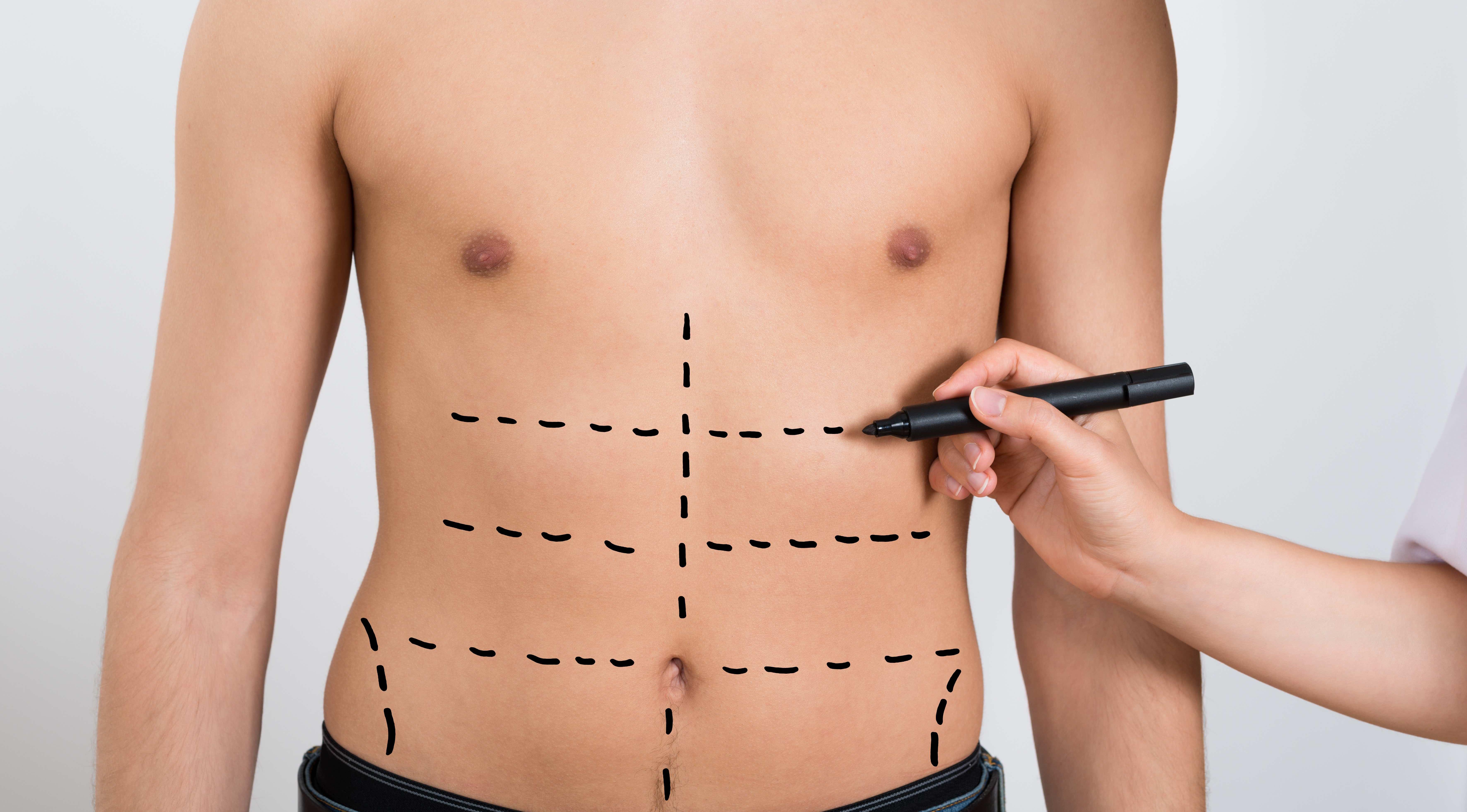 Increase in demand for cosmetic procedures among British men