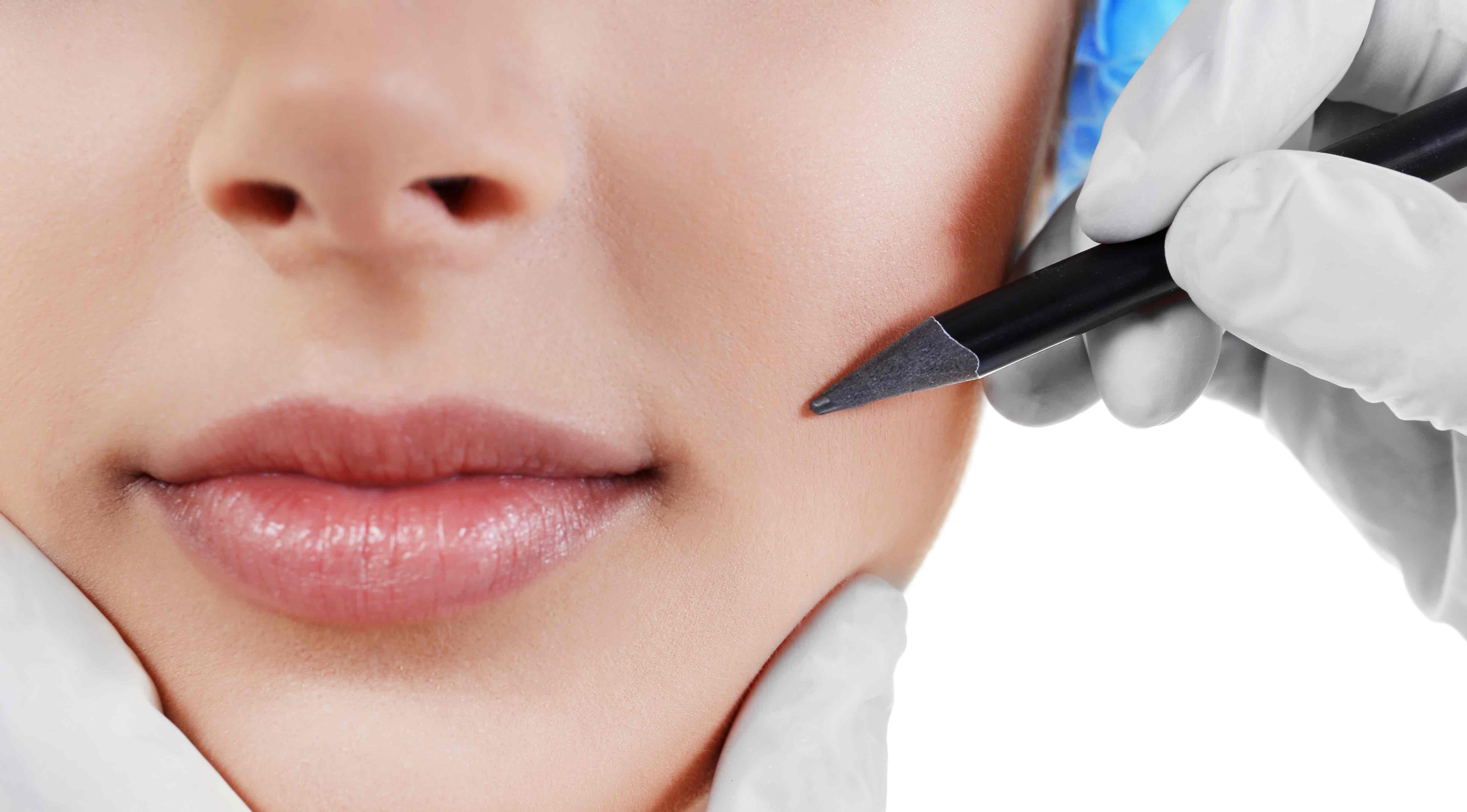 Medicos RX trademarks the Hammock-Lift™ for advanced lower facial contouring