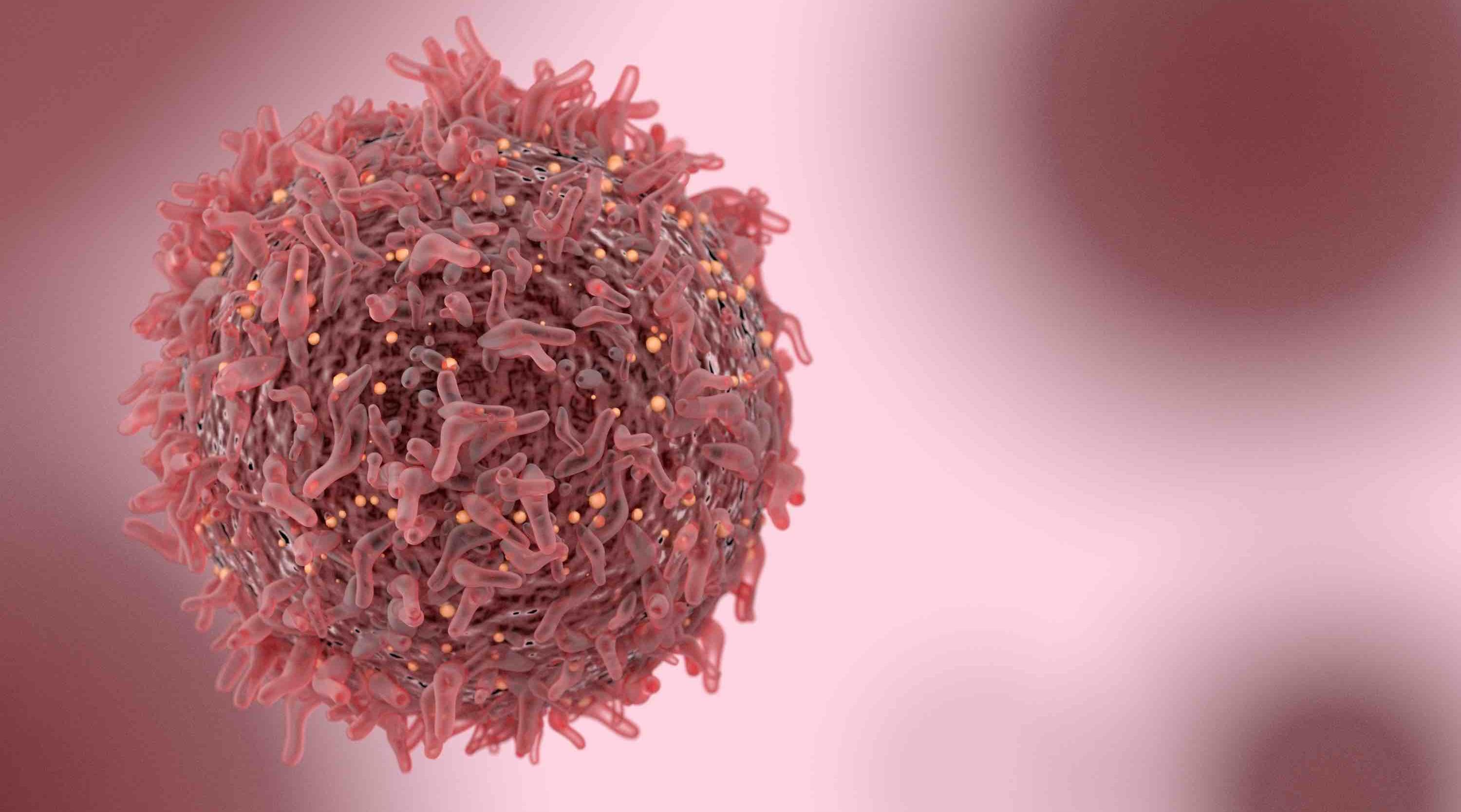 Rare cancer linked with textured implants under reported