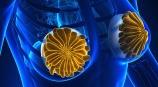 Patients must be told of risks of ALCL before being fitted with textured breast implants