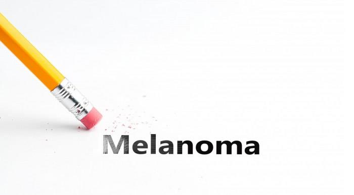NICE publishes new guideline on melanoma