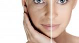 Hydroquinone-free products drive growth