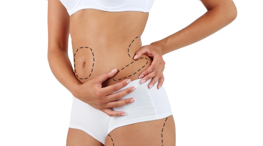 International Liposculpting Training Academy to host Body Contouring Training Day in London 