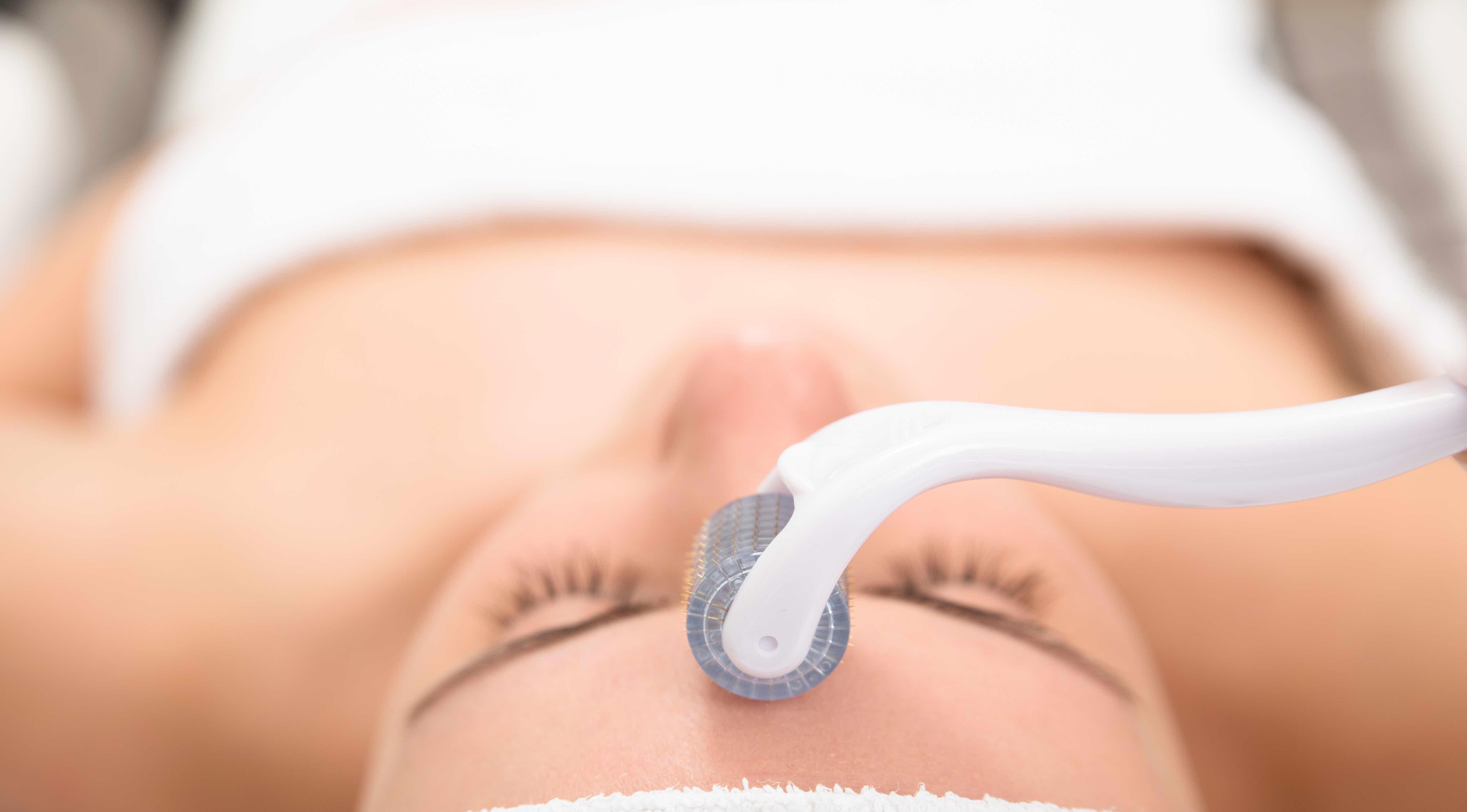 EF Medispa reports rise in microneedling 