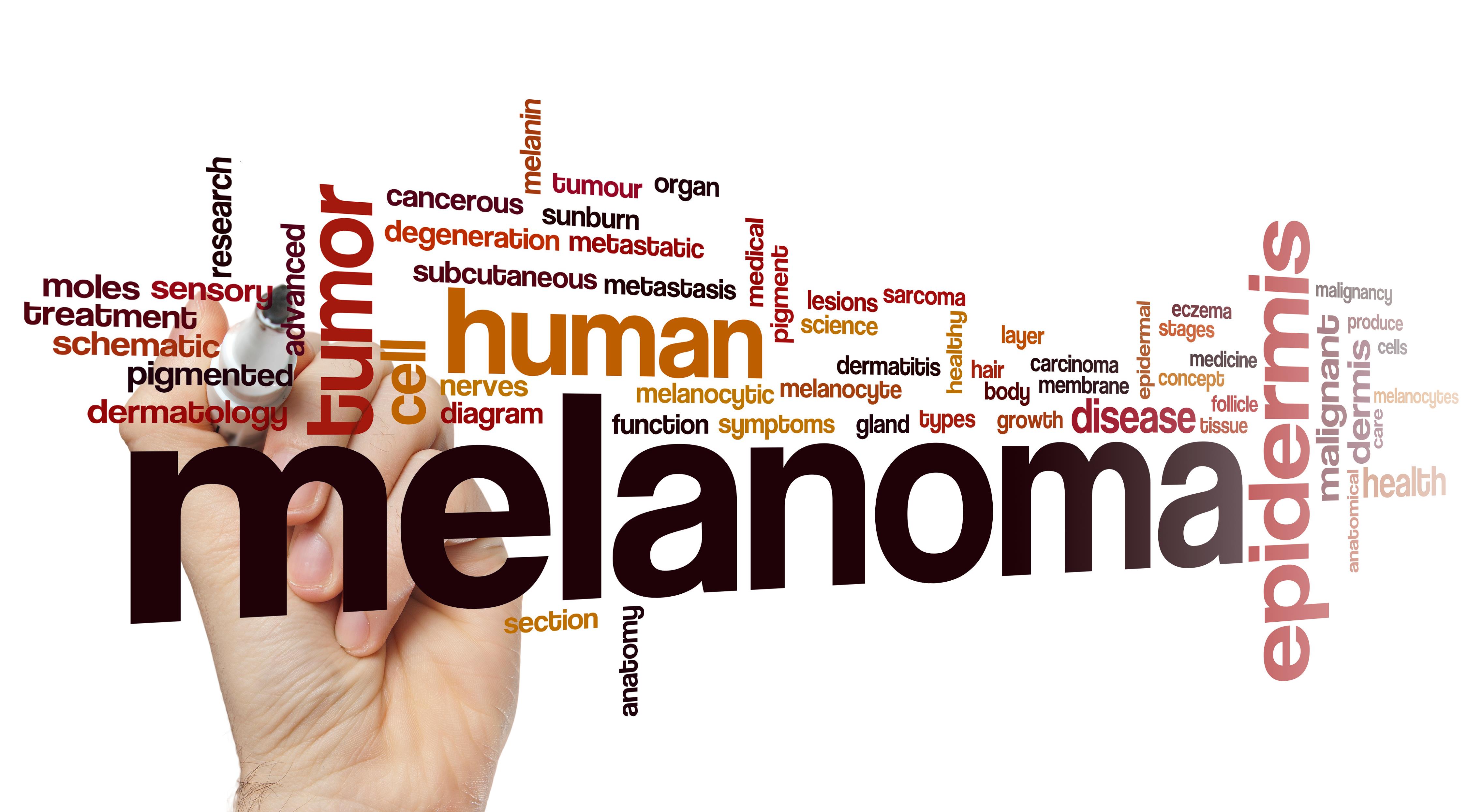 Epigenomic changes play an important role during the progression of melanoma, researchers reveal