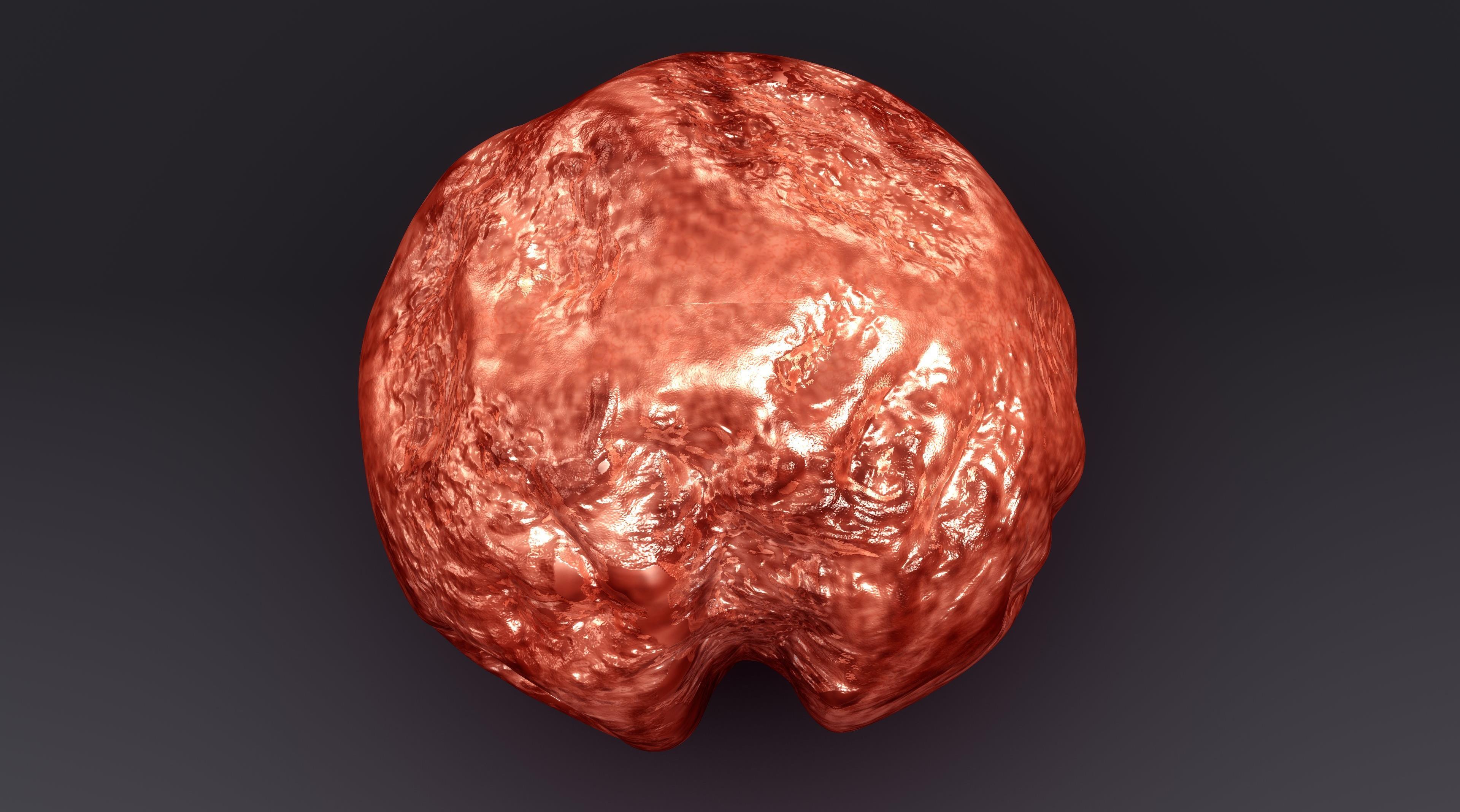 Study examines role of high-frequency ultrasound in distinguishing granulomas from nodular deposits