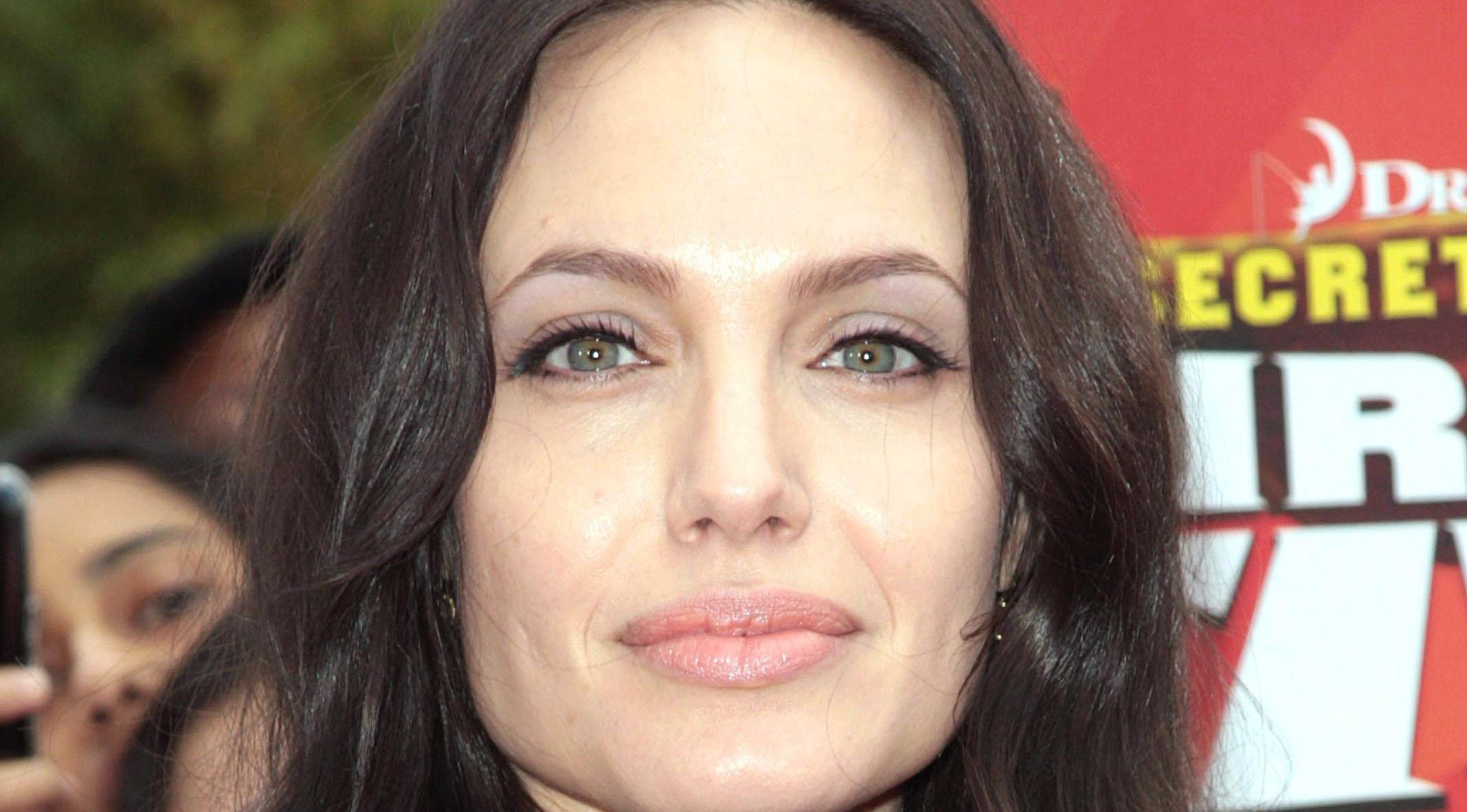 Celebrity look-alike surgery on the rise, says AAFPRS