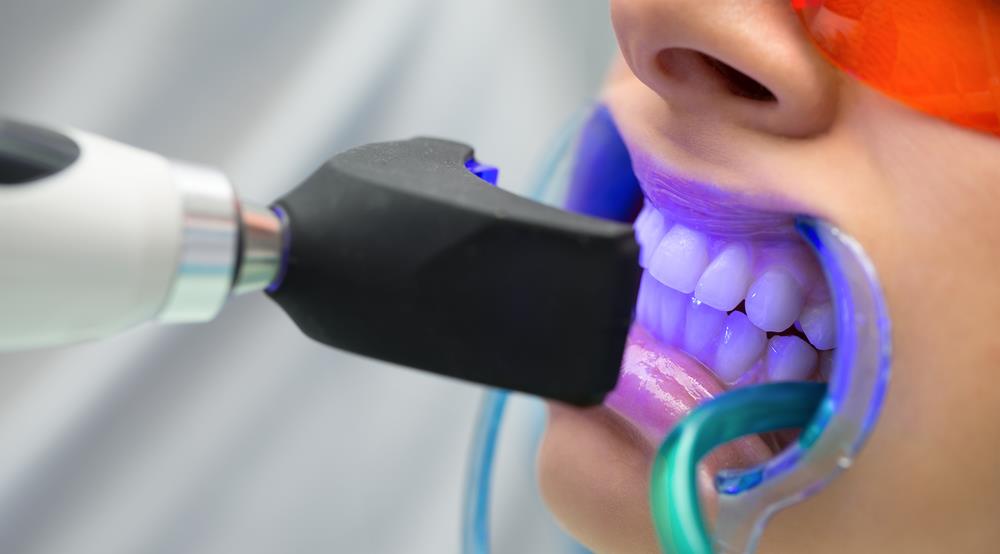 18 successful teeth whitening convictions in the past 12 months