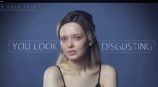 Powerful video showing devastating impact of acne goes viral