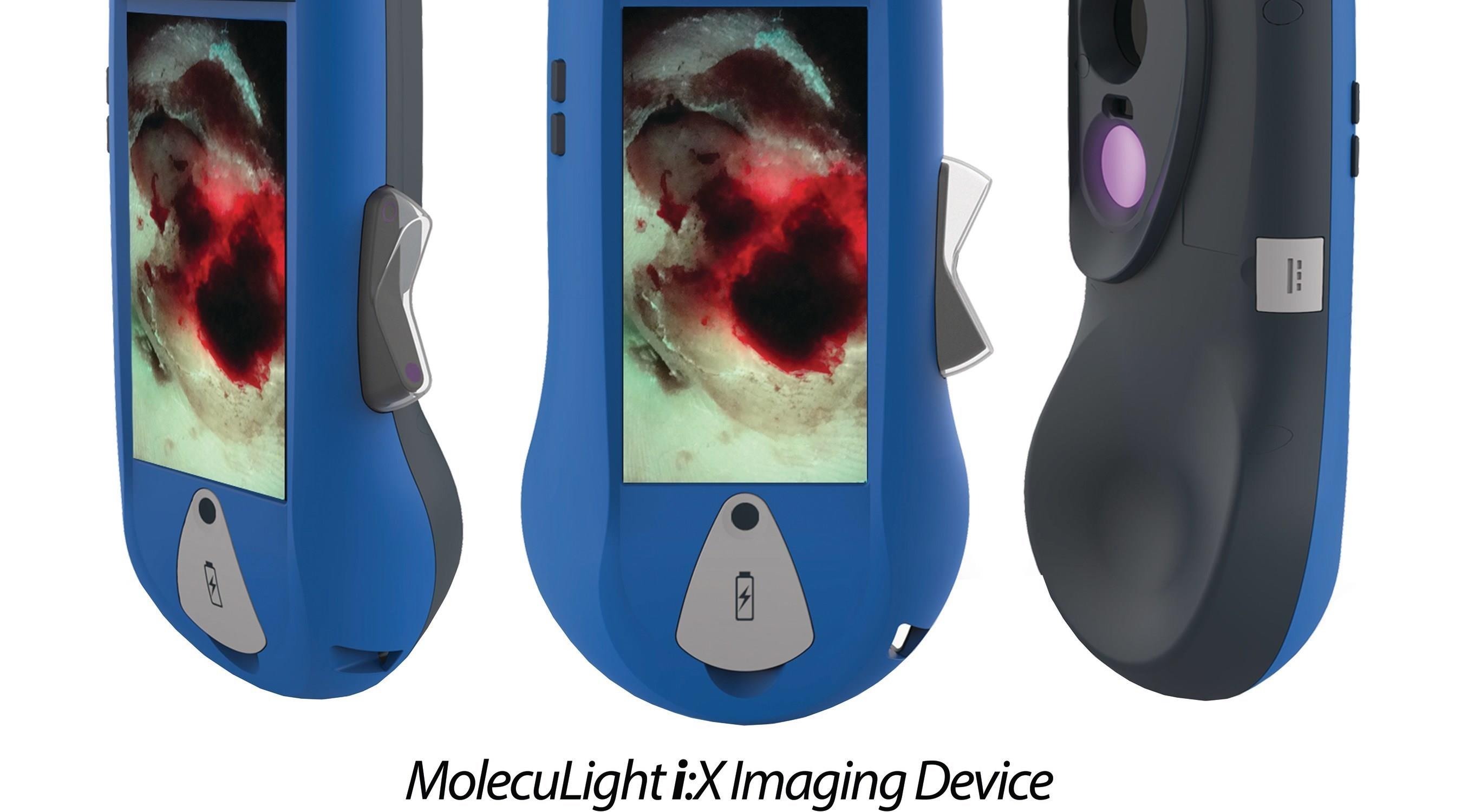 Aesthetic Medicine - Smith & Nephew announce European launch of ...