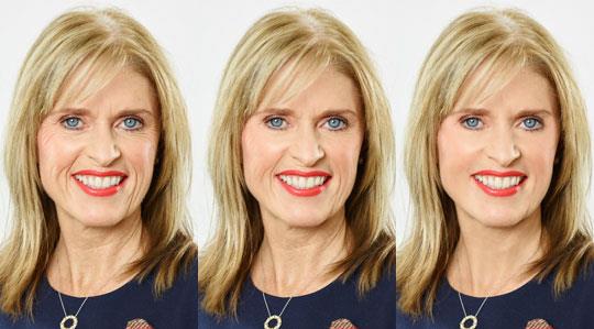 Allergan research reveals attitudes to ageing