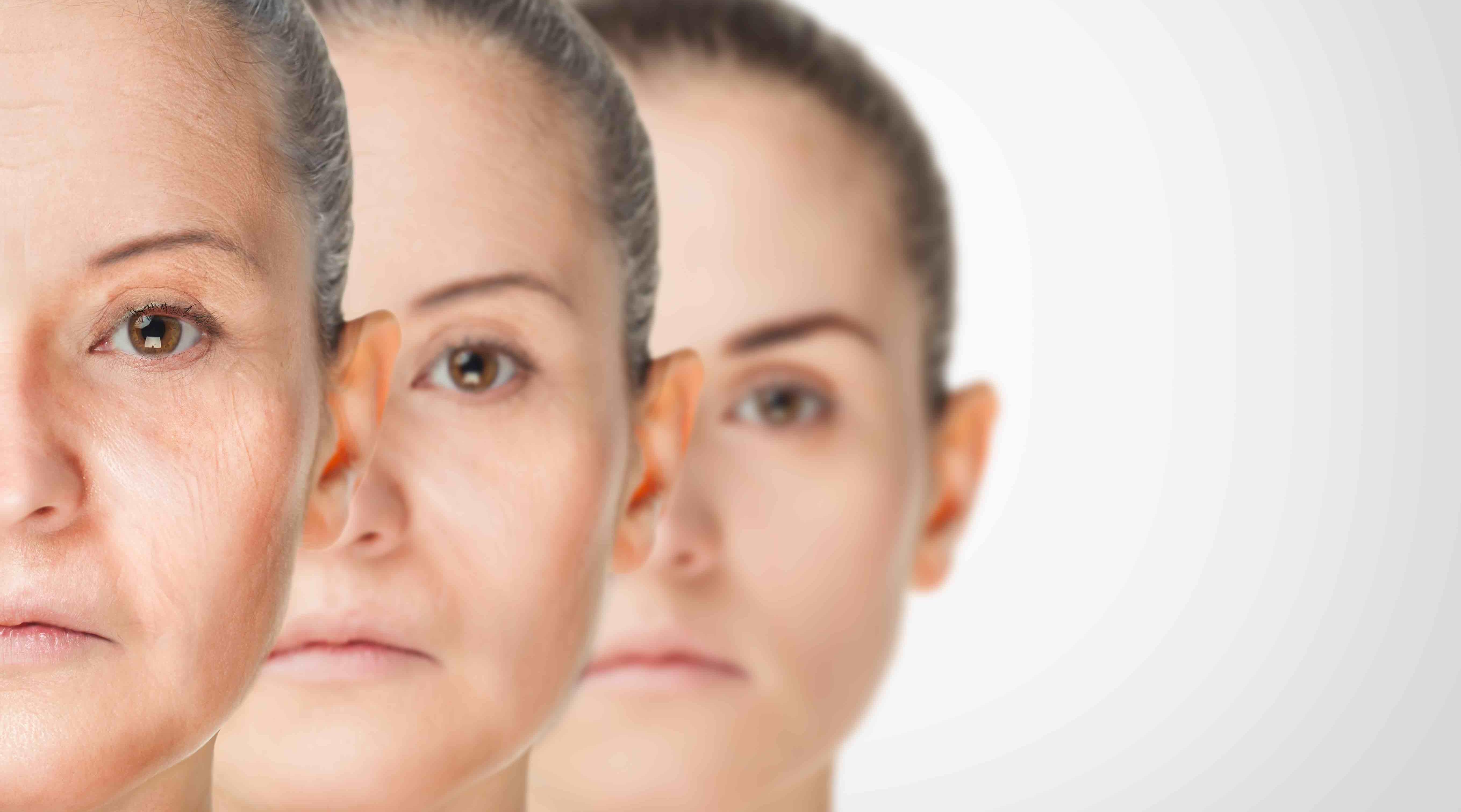 Platelet-rich plasma plus hyaluronic acid improves skin rejuvenation
