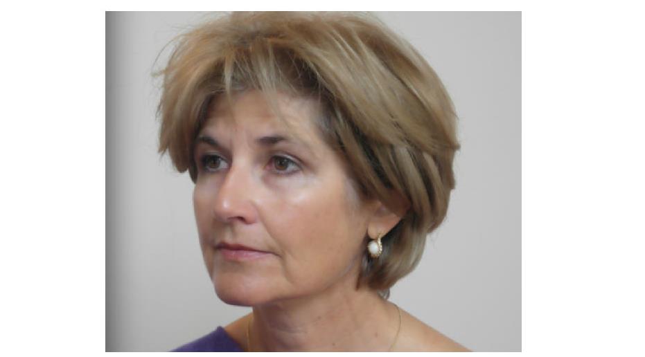 Sponsored Feature: Collagen Replacement Therapy    