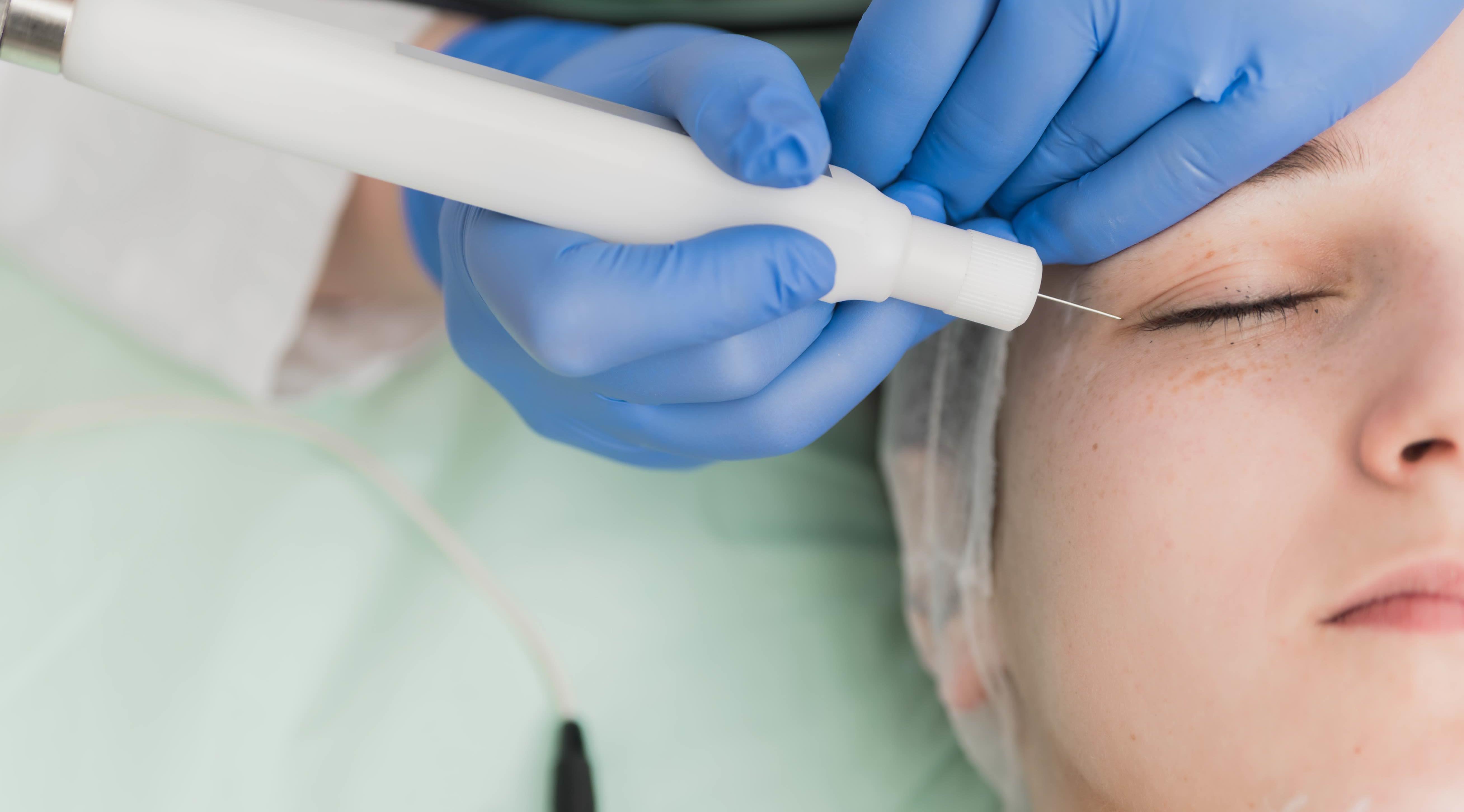 Everything you need to know about safe plasma treatments