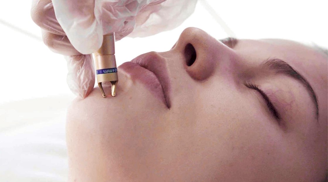 New laser device launches for the effective removal of thread veins