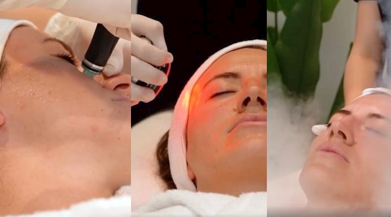 With a Chill and Charm Therapy, Your Skin Will Be Born Again