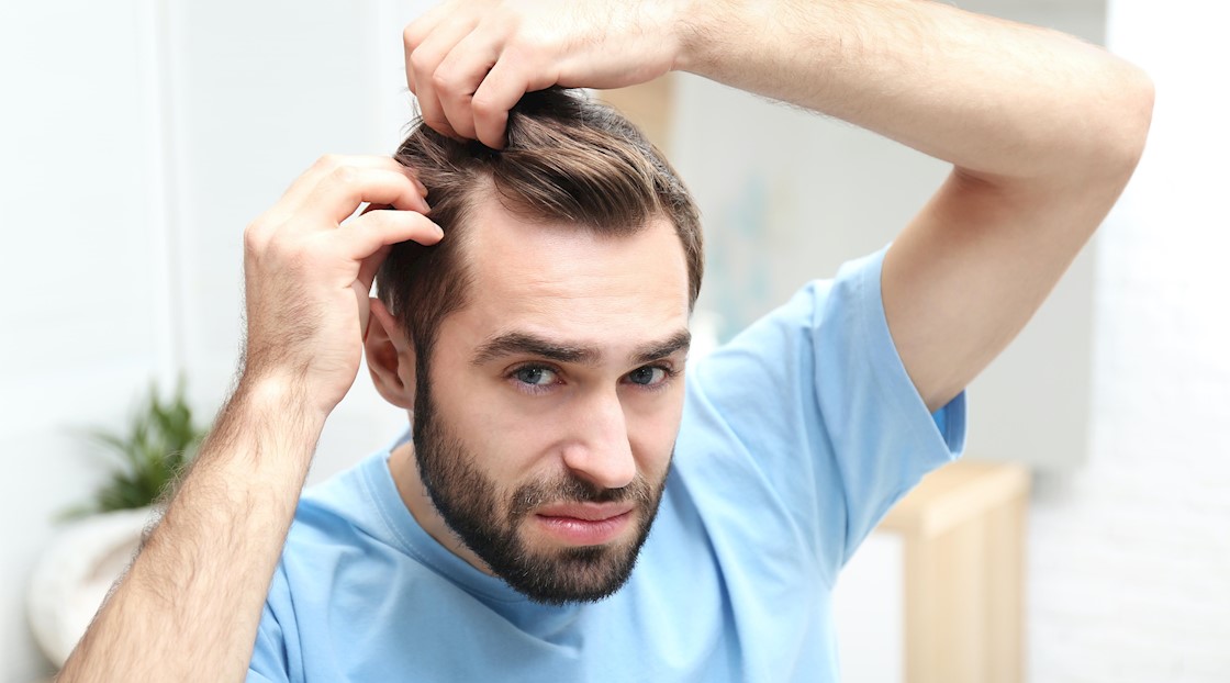 Does creatine cause hair loss?