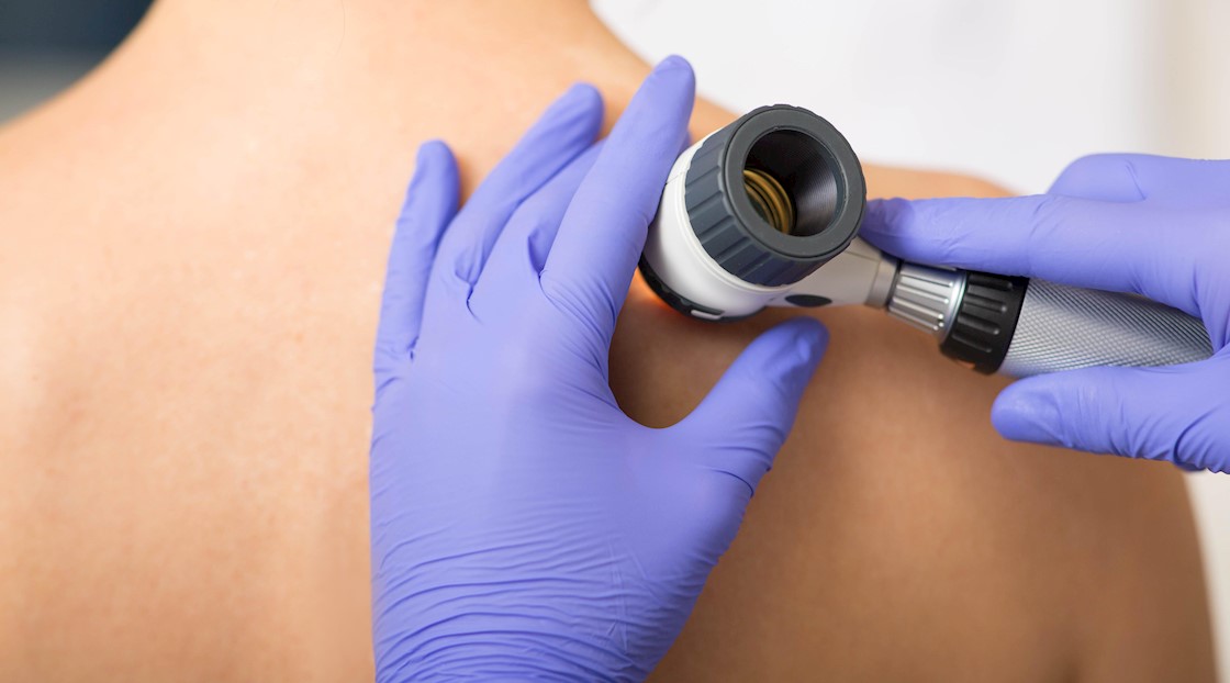 Ivanmed announces collaboration with Map My Mole