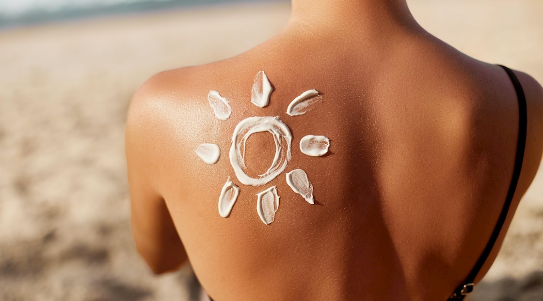 The British Association of Dermatologists issues warning about sunburn in the UK