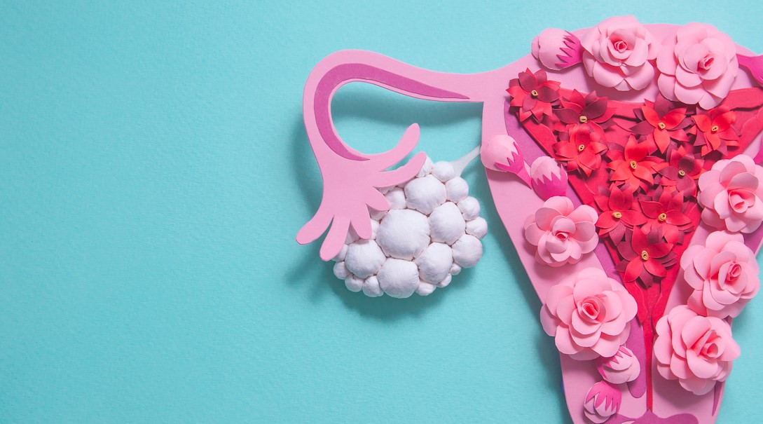 Treating the aesthetic symptoms of PCOS
