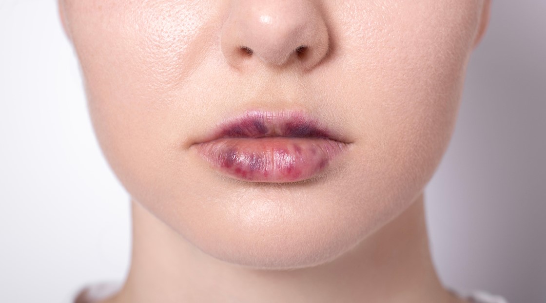 Why an understanding of hormones is important for aesthetic doctors 
