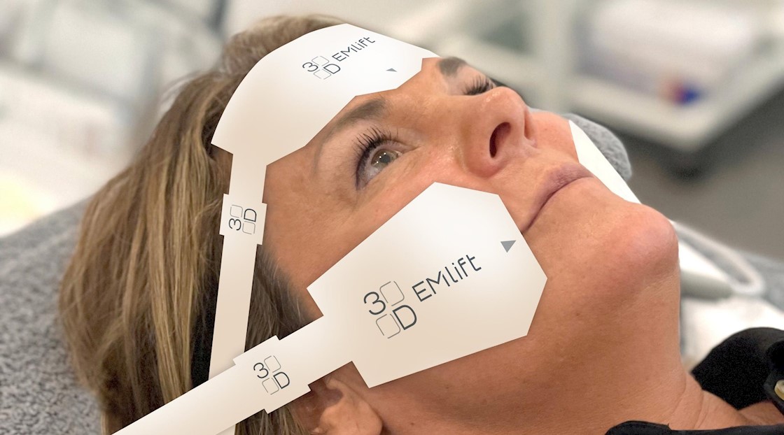 Can this device lift better than botulinum toxin?