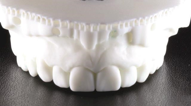 The art of the trial smile in cosmetic dentistry