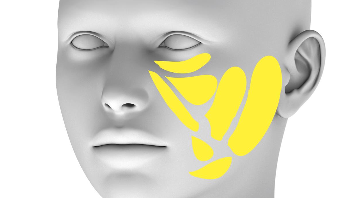 Functional anatomy of the deep facial fat compartments investigated in study 