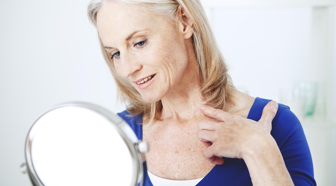 Radiesse injectable approved for new indication