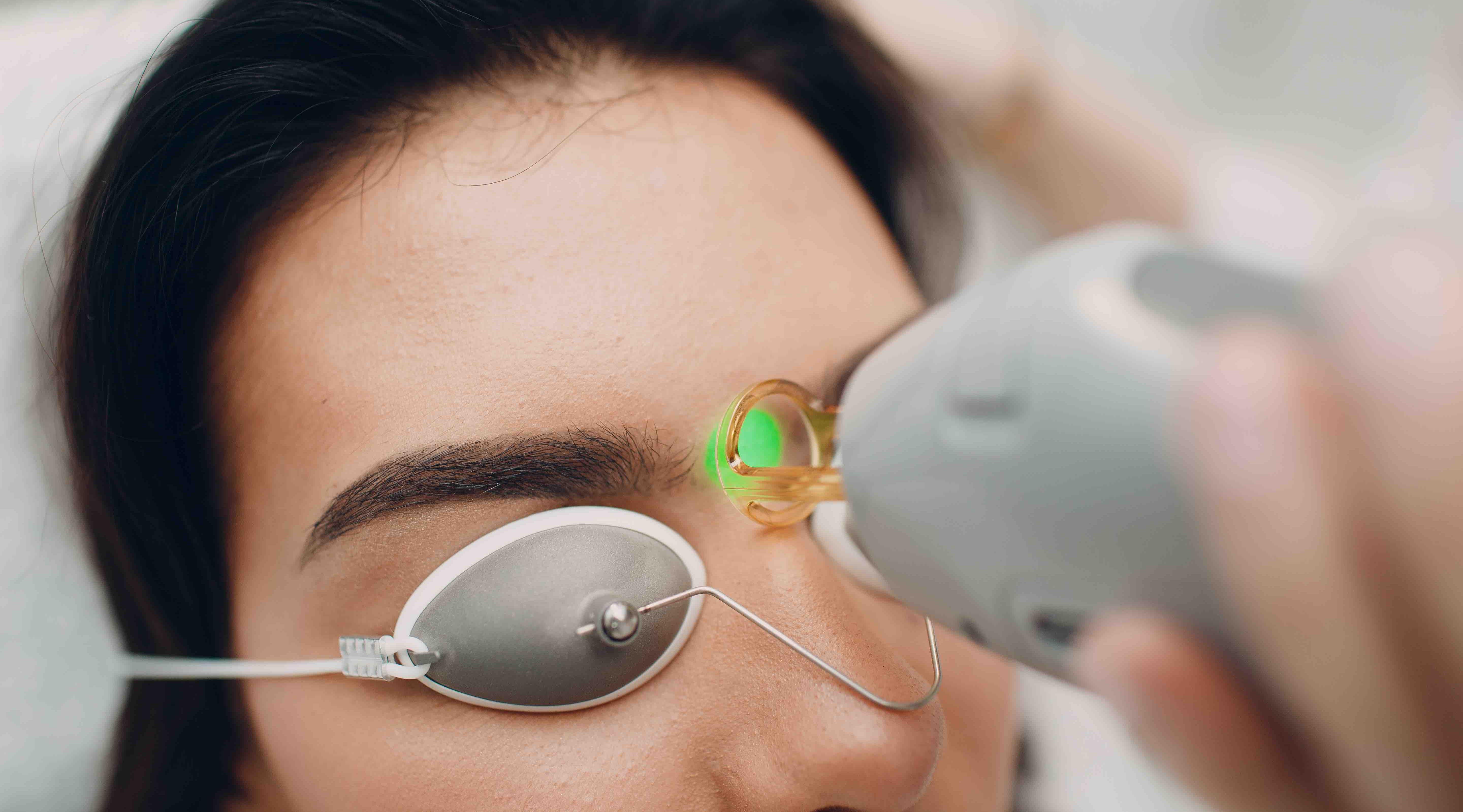 Study finds picosecond more effective than Q-switched laser at eyebrow tattoo removal