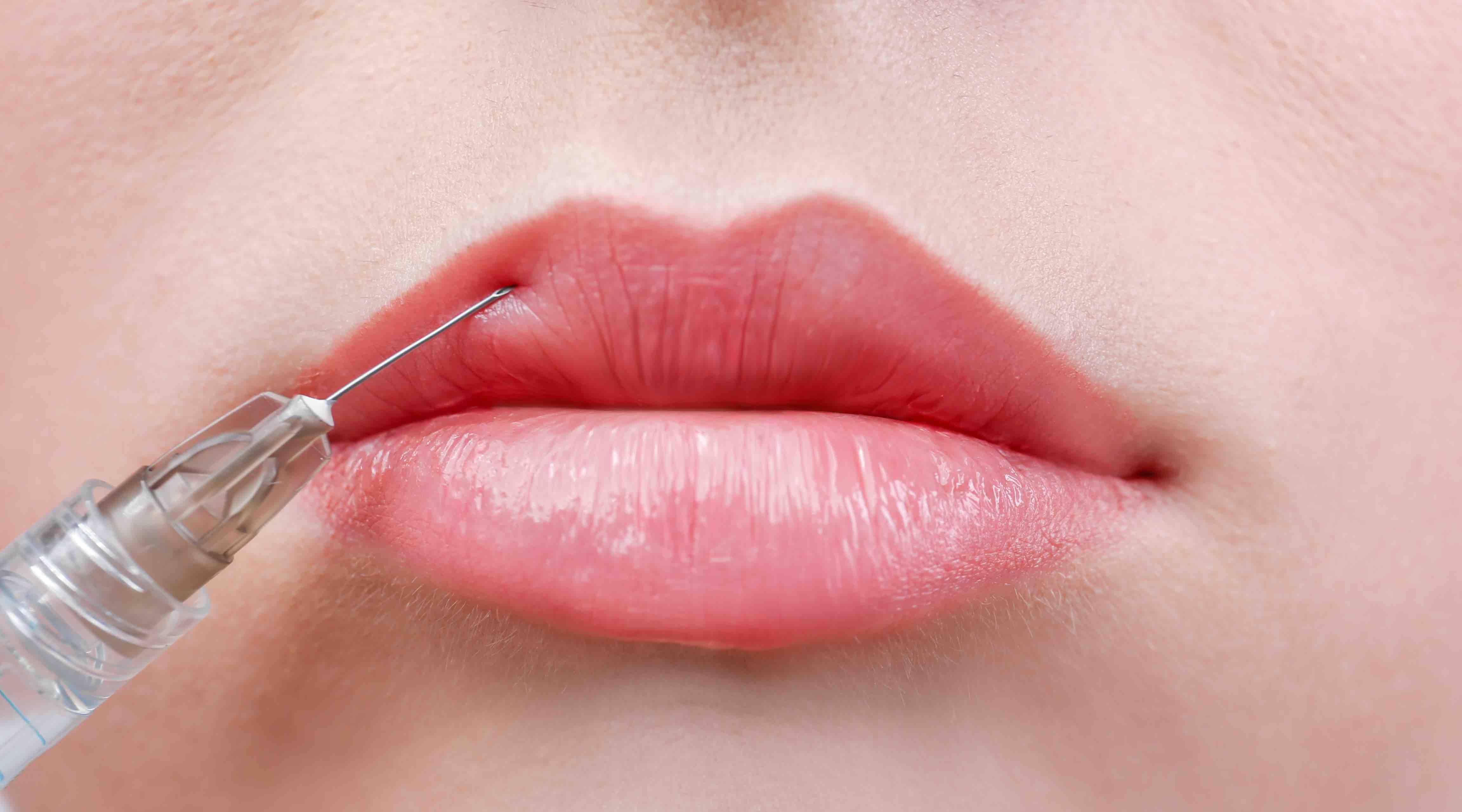 Dangerous dermal filler practices exposed on The Kyle Files