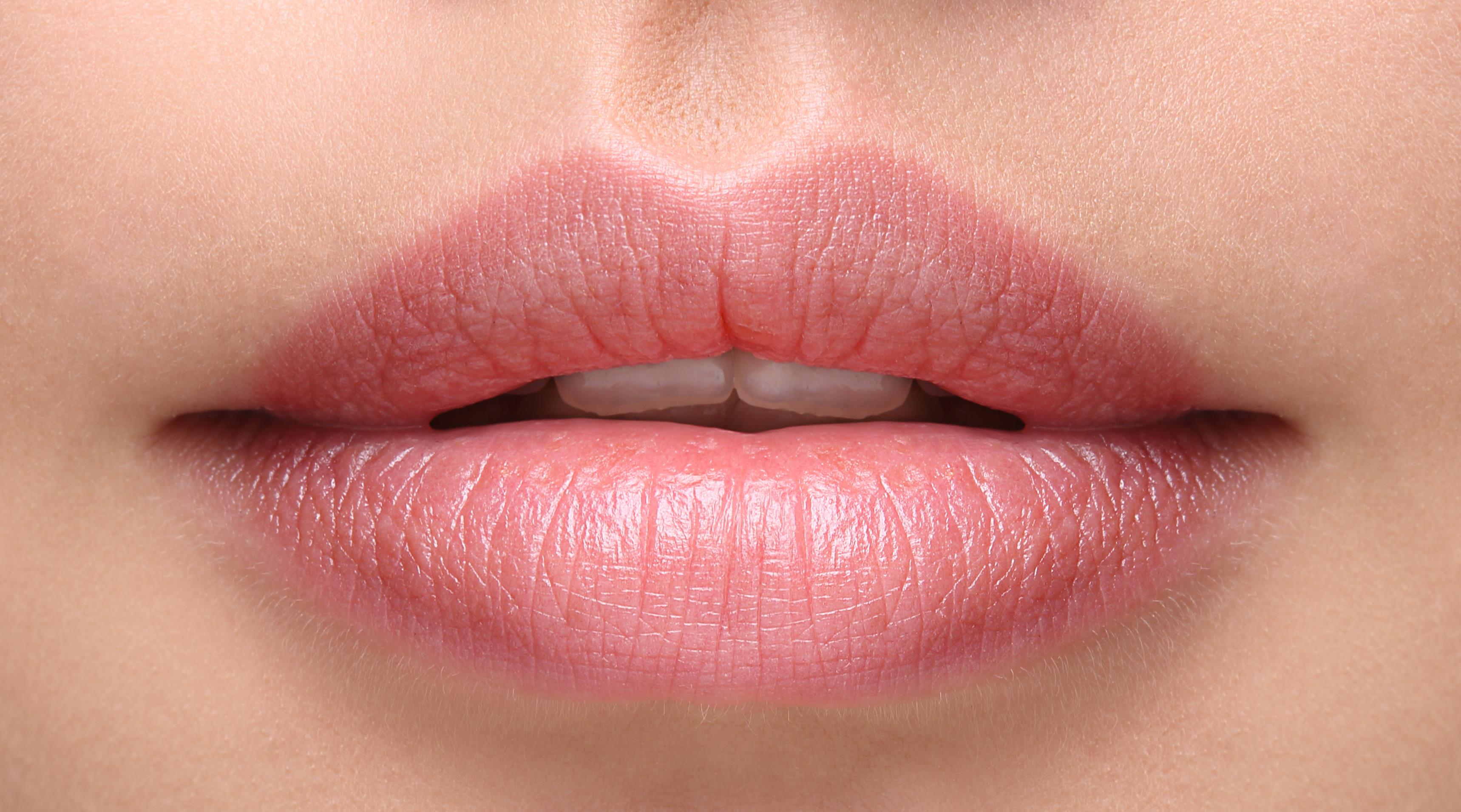 The non-surgical lip lift