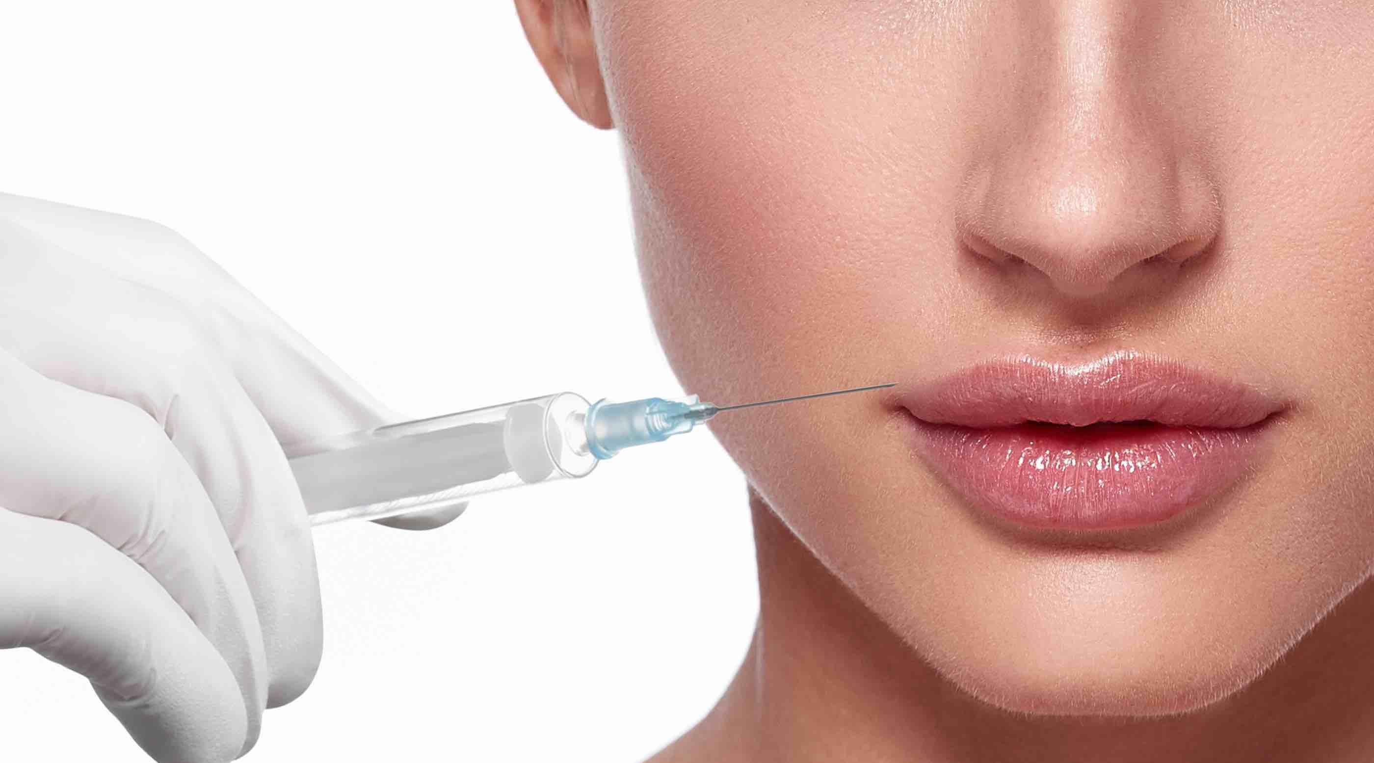 Safety and effectiveness of hyaluronic acid lip fillers assessed