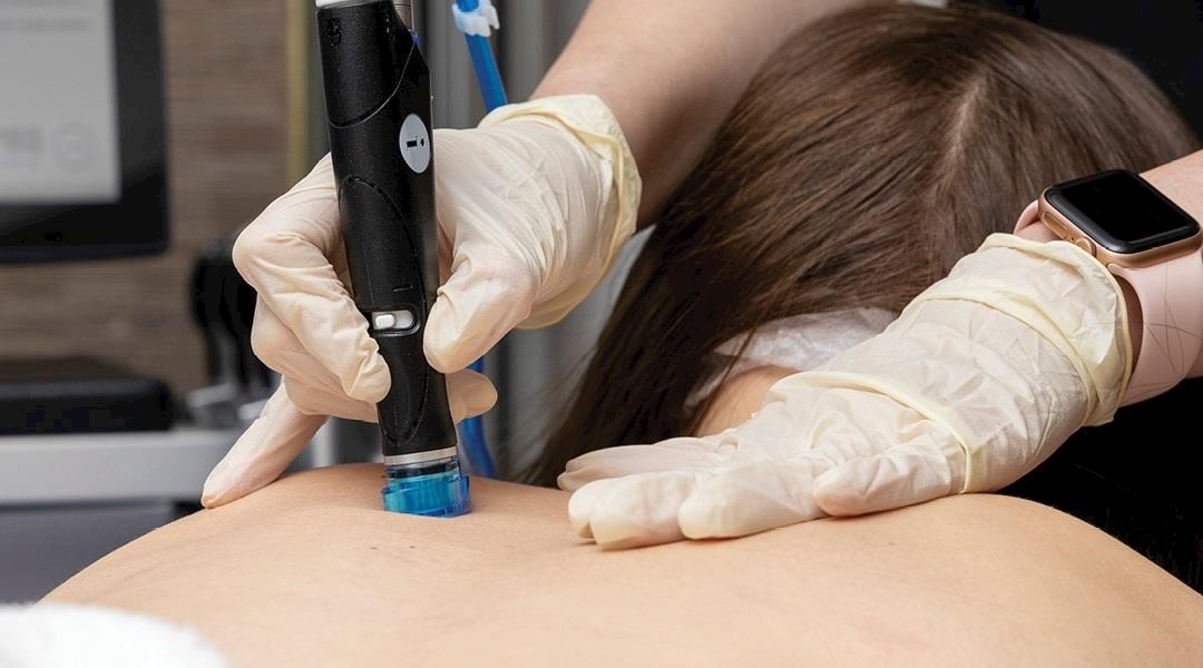 HydraFacial launches HydraBody range