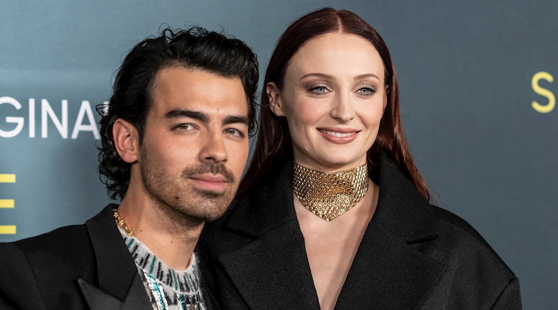 Is Joe Jonas the new face of “Brotox?”