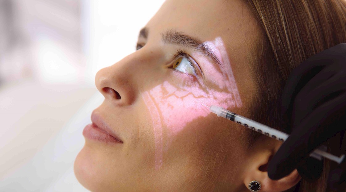 Why ultrasound scanning is a must for dermal filler injectors 
