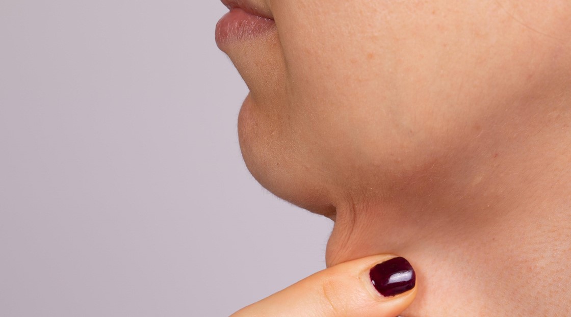 How to treat ‘turkey neck’