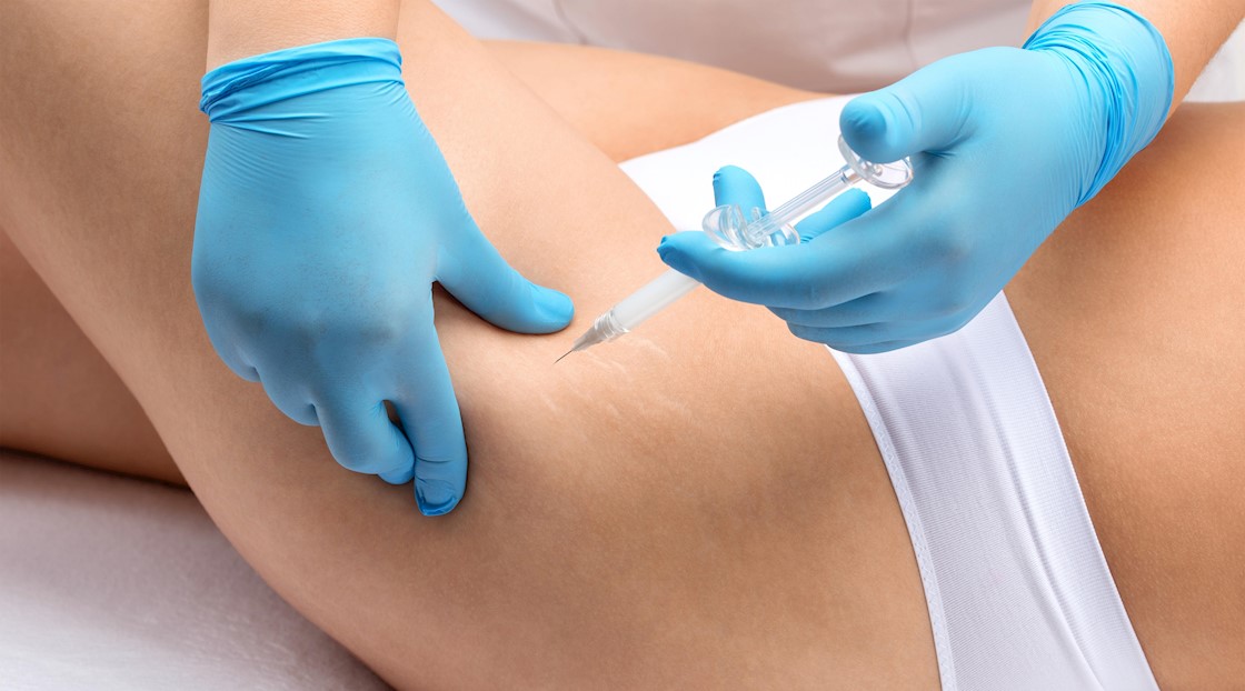 Fat loss injections like Ozempic are trending but are they dangerous?