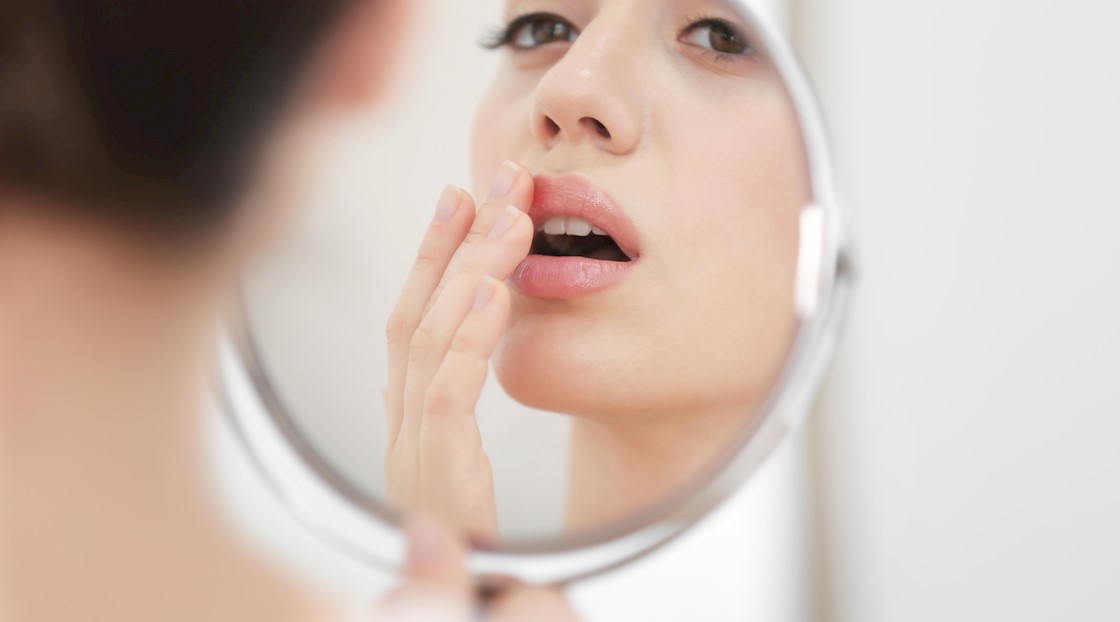 How to safely treat patients with cold sores
