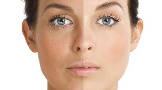 Want to know how leading practitioners treat sun damage and pigmentation? 