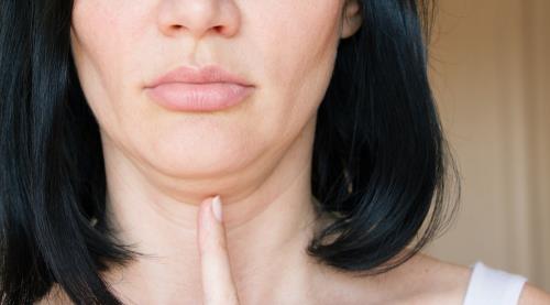 One in eight clueless how to reduce double chins