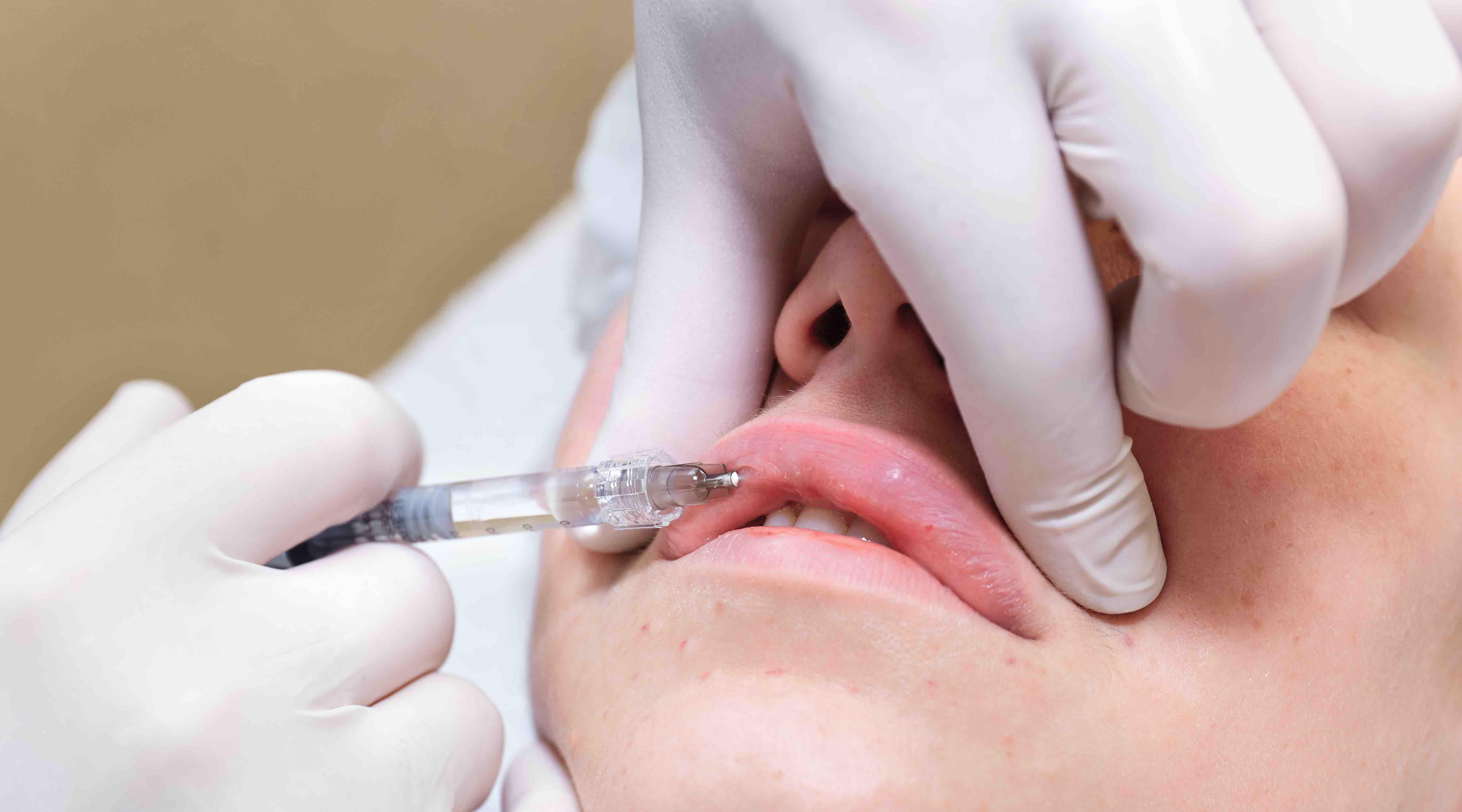 Government pledges to launch campaign against botched injectables