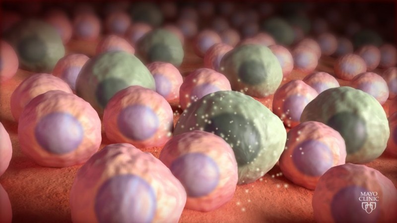 Drugs that kill ‘zombie’ cells may benefit some women but not all, study finds