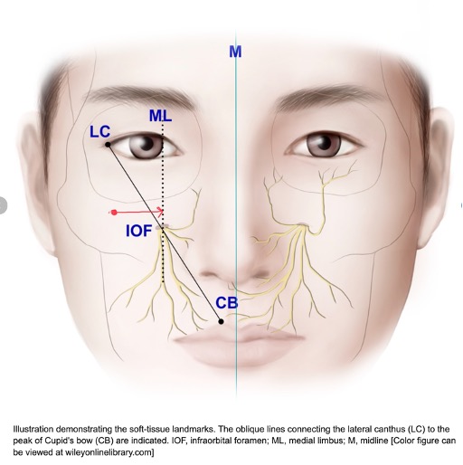 Expert guidance on aesthetic treatments for Chinese features