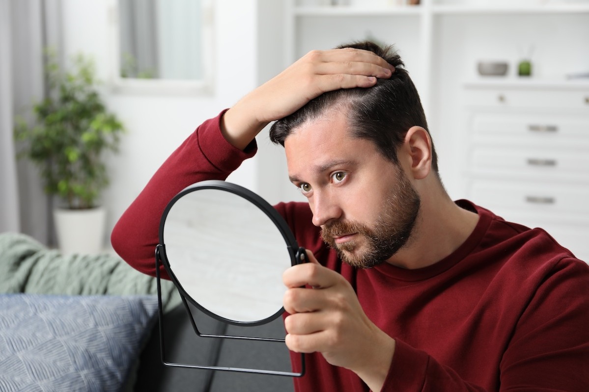 Newcastle upon Tyne tops UK’s list of cities most concerned about hair loss