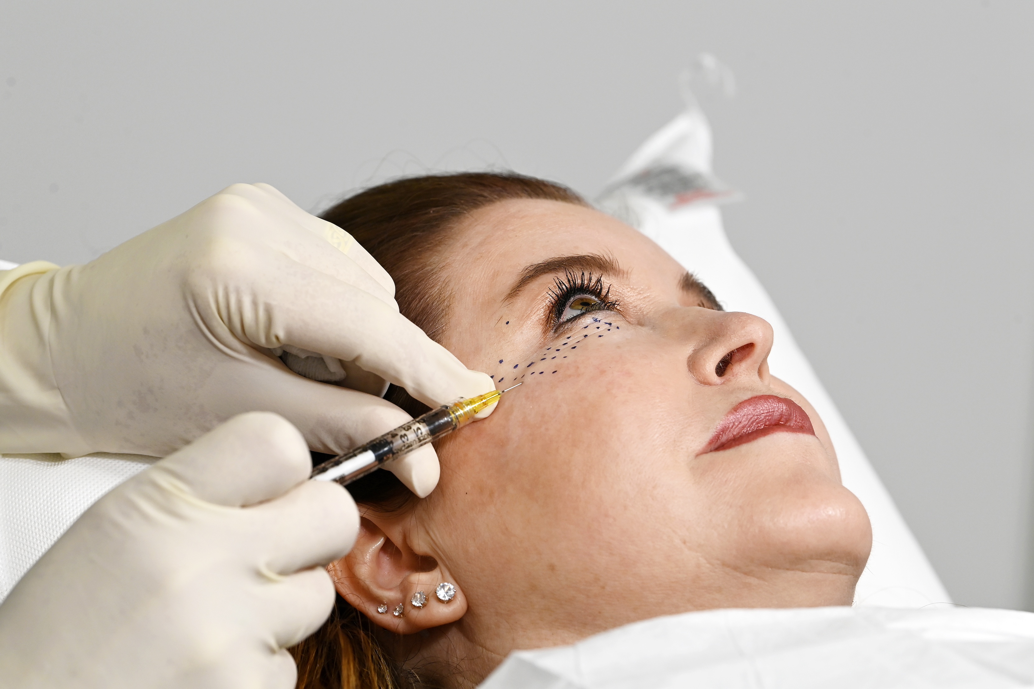 Explore the latest injectables and clinical trends at Aesthetic Medicine London 2026