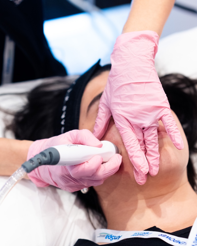 How to achieve “glass skin” results with the new Glacē treatment from Candela